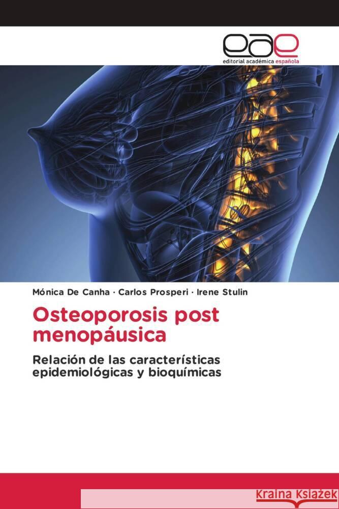 Osteoporosis post menopáusica De Canha, Mónica, Prosperi, Carlos, Stulin, Irene 9786203885941