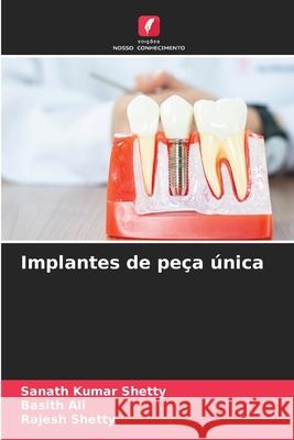 Implantes de peça única Shetty, Sanath Kumar, Ali, Basith, Shetty, Rajesh 9786203890068 Edições Nosso Conhecimento