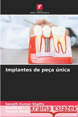 Implantes de peça única Shetty, Sanath Kumar, Ali, Basith, Shetty, Rajesh 9786203890068