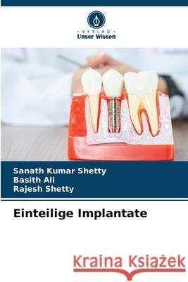 Einteilige Implantate Shetty, Sanath Kumar, Ali, Basith, Shetty, Rajesh 9786203890075 Verlag Unser Wissen