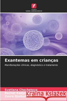 Exantemas em crianças Chechetova, Svetlana, Kadyrova, Rachat, Djolbunova, Zuura 9786203892079 Edições Nosso Conhecimento