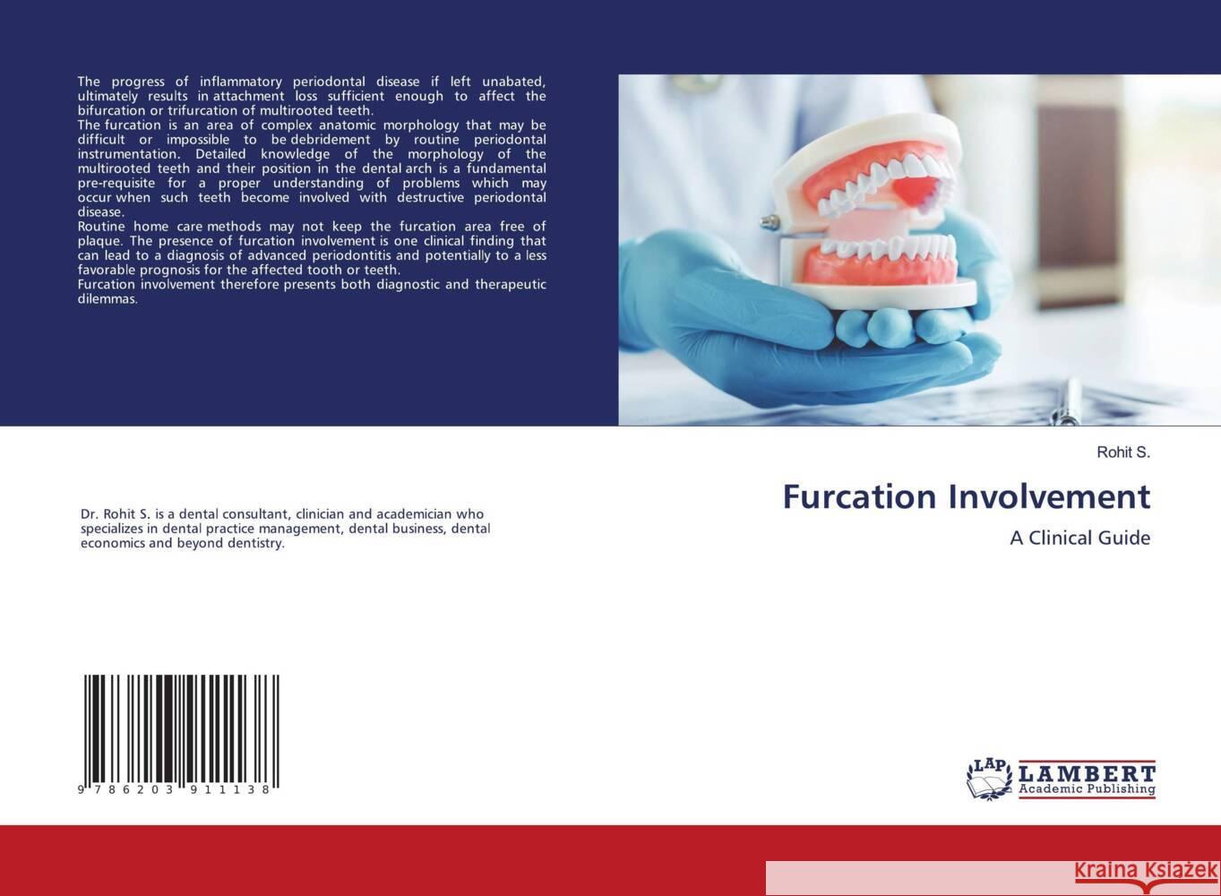 Furcation Involvement S., Rohit 9786203911138 LAP Lambert Academic Publishing