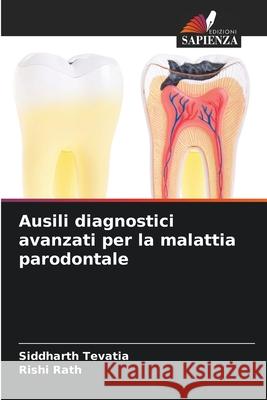 Ausili diagnostici avanzati per la malattia parodontale Tevatia, Siddharth, Rath, Rishi 9786203917727 Edizioni Sapienza