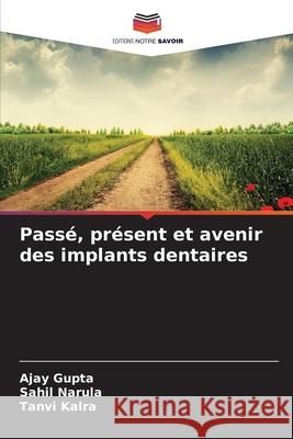 Passé, présent et avenir des implants dentaires Gupta, Ajay, Narula, Sahil, Kalra, Tanvi 9786203917864 Editions Notre Savoir