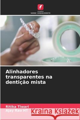Alinhadores transparentes na dentição mista Tiwari, Ritika, Rao HT, Ajay 9786203918649
