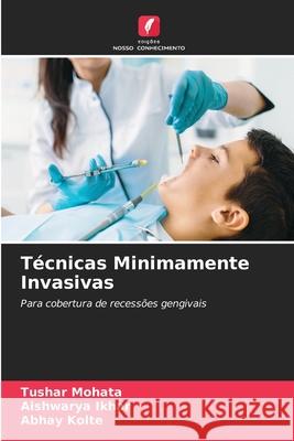 Técnicas Minimamente Invasivas MOHATA, TUSHAR, Ikhar, Aishwarya, KOLTE, ABHAY 9786203921236 Edições Nosso Conhecimento