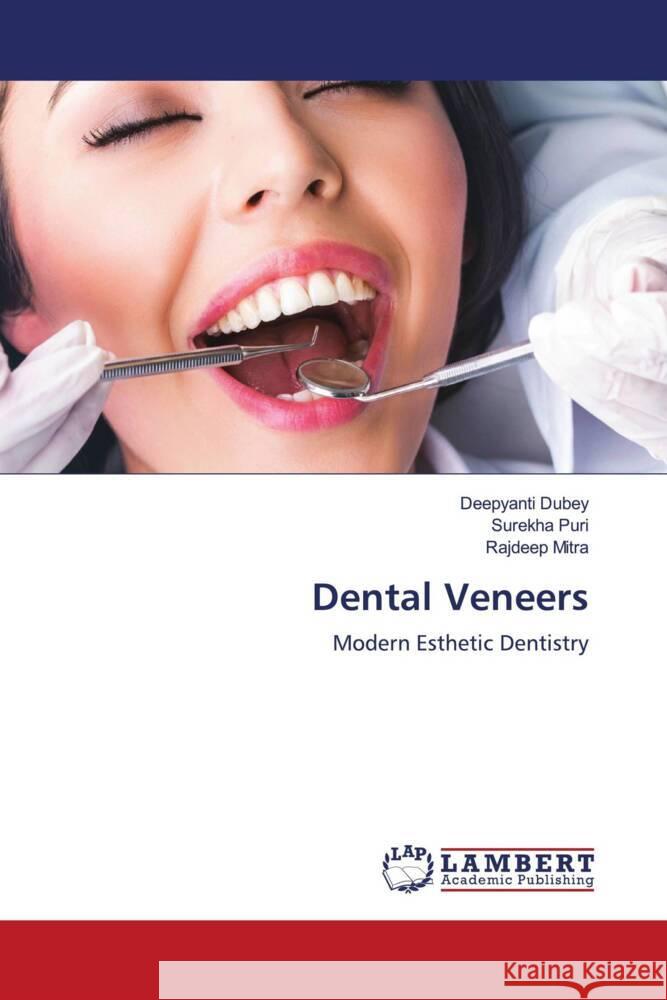 Dental Veneers DUBEY, Deepyanti, puri, surekha, Mitra, Rajdeep 9786203922349 LAP Lambert Academic Publishing