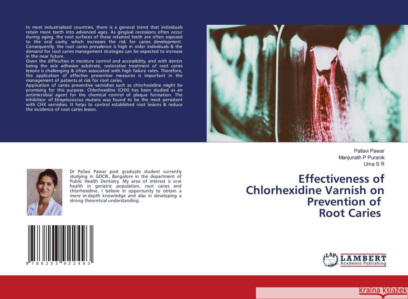 Effectiveness of Chlorhexidine Varnish on Prevention of Root Caries Pawar, Pallavi, Puranik, Manjunath P, S. R., Uma 9786203922493 LAP Lambert Academic Publishing