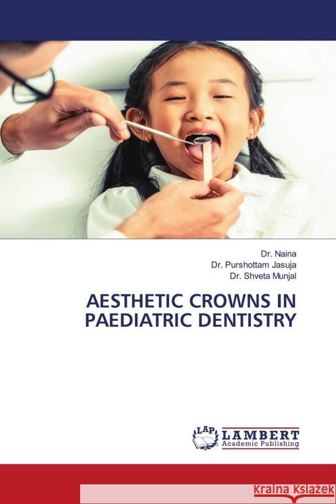 AESTHETIC CROWNS IN PAEDIATRIC DENTISTRY Naina, Dr., Purshottam Jasuja, Dr., Shveta Munjal, Dr. 9786203925173