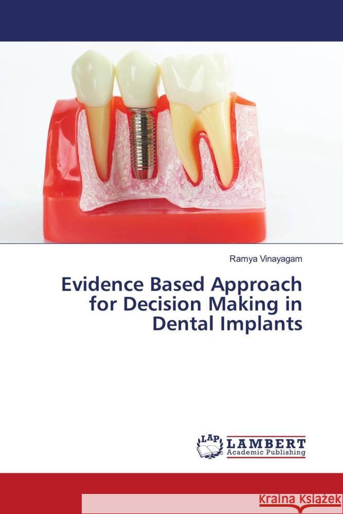 Evidence Based Approach for Decision Making in Dental Implants Vinayagam, Ramya 9786203925616