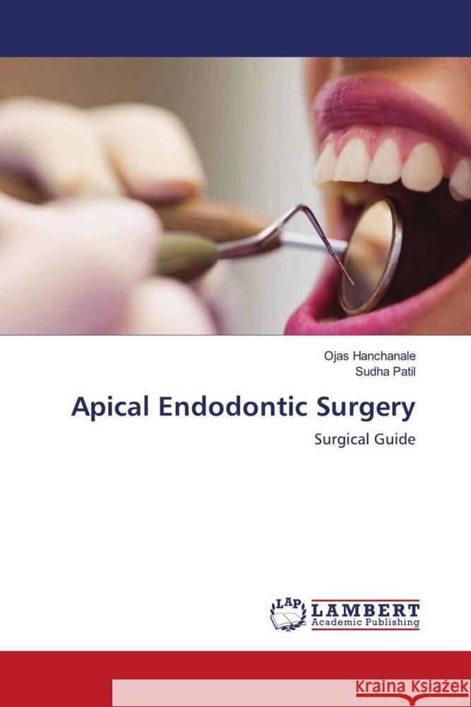 Apical Endodontic Surgery Hanchanale, Ojas, Patil, Sudha 9786203927122