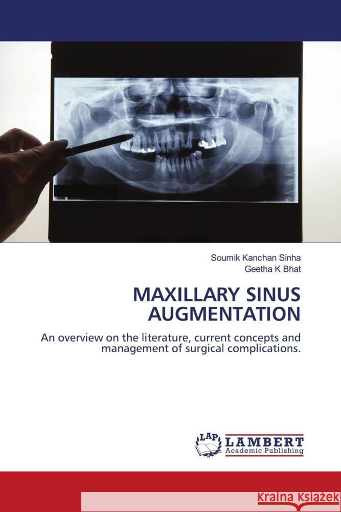 MAXILLARY SINUS AUGMENTATION Sinha, Soumik Kanchan, Bhat, Geetha K 9786203927733