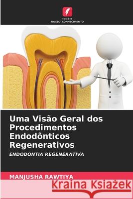 Uma Visão Geral dos Procedimentos Endodônticos Regenerativos Manjusha Rawtiya 9786203945270 Edicoes Nosso Conhecimento