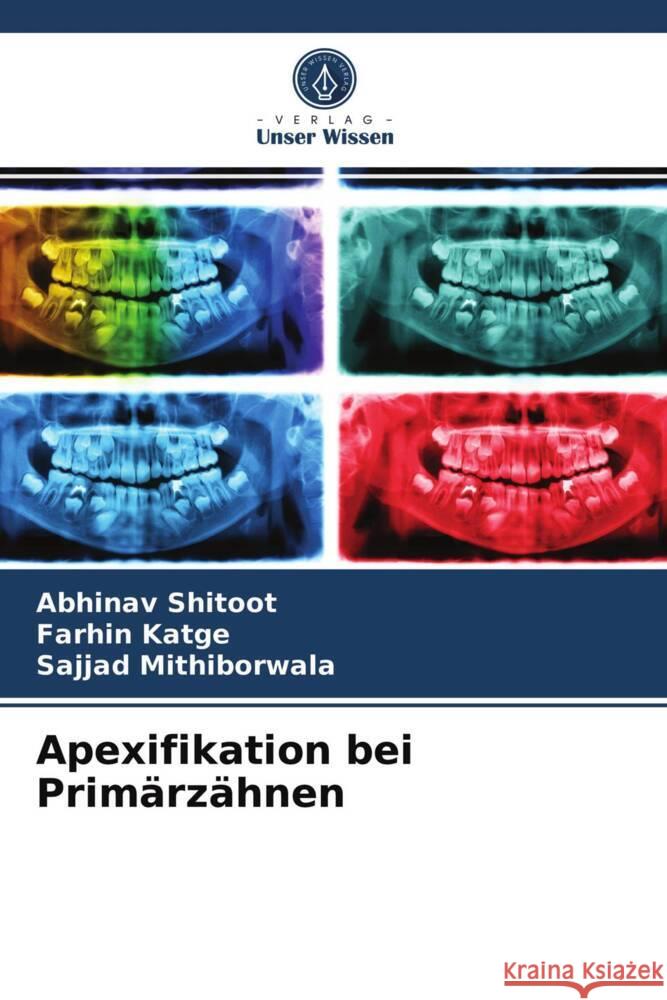 Apexifikation bei Primärzähnen Shitoot, Abhinav, Katge, Farhin, Mithiborwala, Sajjad 9786203969344