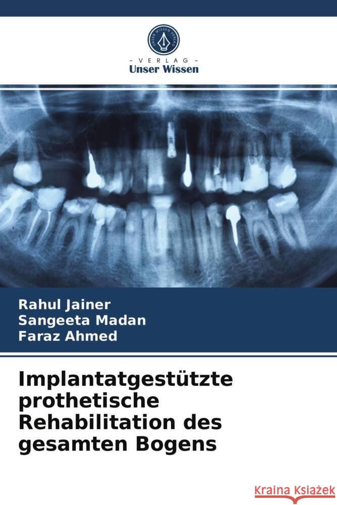 Implantatgestützte prothetische Rehabilitation des gesamten Bogens Jainer, Rahul, Madan, Sangeeta, Ahmed, Faraz 9786203985047 Verlag Unser Wissen