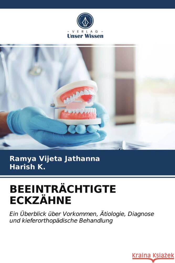 BEEINTRÄCHTIGTE ECKZÄHNE Jathanna, Ramya Vijeta, K., Harish 9786204008929 Verlag Unser Wissen