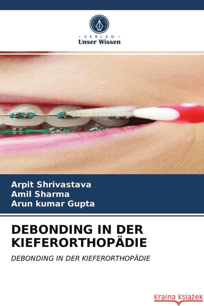 DEBONDING IN DER KIEFERORTHOPÄDIE Shrivastava, Arpit, Sharma, Amil, Gupta, Arun Kumar 9786204012391