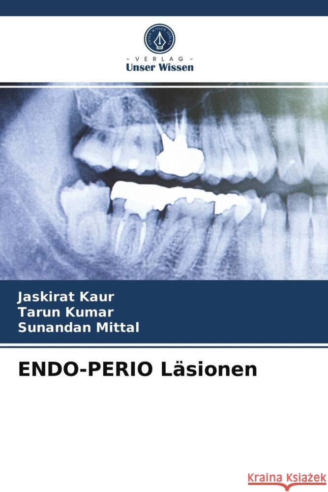 ENDO-PERIO Läsionen Kaur, Jaskirat, Kumar, Tarun, Mittal, Sunandan 9786204018393 Verlag Unser Wissen