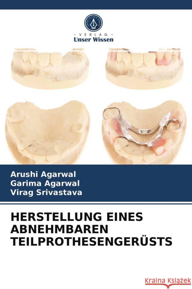 HERSTELLUNG EINES ABNEHMBAREN TEILPROTHESENGERÜSTS Agarwal, Arushi, Agarwal, Garima, Srivastava, Virag 9786204023397