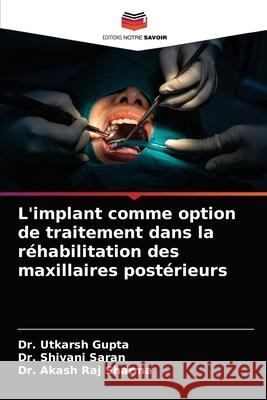 L'implant comme option de traitement dans la réhabilitation des maxillaires postérieurs Gupta, Utkarsh 9786204032368 Editions Notre Savoir