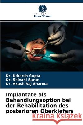 Implantate als Behandlungsoption bei der Rehabilitation des posterioren Oberkiefers Dr Utkarsh Gupta, Dr Shivani Saran, Dr Akash Raj Sharma 9786204032375