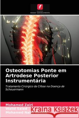 Osteotomias Ponte em Artrodese Posterior Instrumentária Mohamed Zairi, Walid Saied, Mohamed Nabil Nessib 9786204034140 Edicoes Nosso Conhecimento