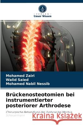 Brückenosteotomien bei instrumentierter posteriorer Arthrodese Mohamed Zairi, Walid Saied, Mohamed Nabil Nessib 9786204034157 Verlag Unser Wissen