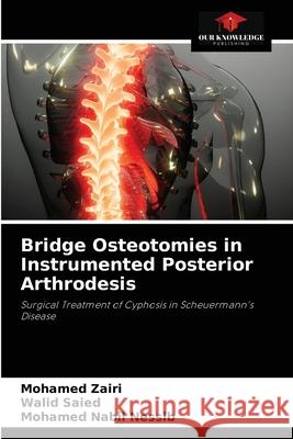 Bridge Osteotomies in Instrumented Posterior Arthrodesis Mohamed Zairi Walid Saied Mohamed Nabil Nessib 9786204034164 Our Knowledge Publishing