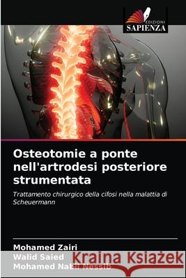 Osteotomie a ponte nell'artrodesi posteriore strumentata Mohamed Zairi Walid Saied Mohamed Nabil Nessib 9786204034188 Edizioni Sapienza