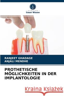 Prothetische Möglichkeiten in Der Implantologie Ranjeet Ghadage, Anjali Mendhe 9786204036717 Verlag Unser Wissen