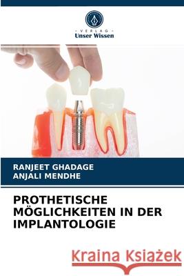 Prothetische Möglichkeiten in Der Implantologie Ranjeet Ghadage, Anjali Mendhe 9786204036717