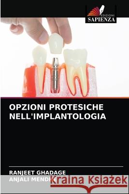 Opzioni Protesiche Nell'implantologia Ranjeet Ghadage, Anjali Mendhe 9786204036748 Edizioni Sapienza