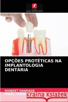 Opções Protéticas Na Implantologia Dentária Ranjeet Ghadage, Anjali Mendhe 9786204036755 Edicoes Nosso Conhecimento