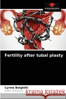 Fertility after tubal plasty Cyrine Belghith Olfa Slimani 9786204040936 Our Knowledge Publishing