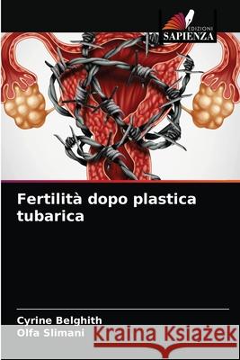 Fertilità dopo plastica tubarica Belghith, Cyrine 9786204040950 Edizioni Sapienza