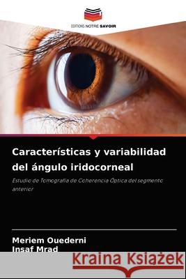 Características y variabilidad del ángulo iridocorneal Ouederni, Meriem 9786204044385 Editions Notre Savoir