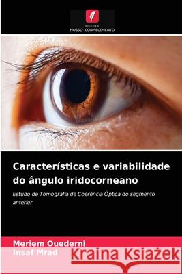 Características e variabilidade do ângulo iridocorneano Meriem Ouederni, Insaf Mrad 9786204044408 Edicoes Nosso Conhecimento