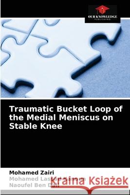 Traumatic Bucket Loop of the Medial Meniscus on Stable Knee Mohamed Zairi Mohamed Lassad Kanoun Naoufel Be 9786204047874