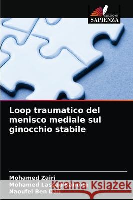 Loop traumatico del menisco mediale sul ginocchio stabile Mohamed Zairi Mohamed Lassad Kanoun Naoufel Be 9786204047898