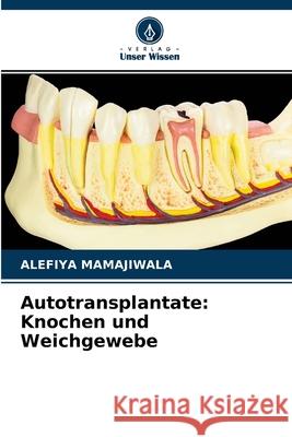 Autotransplantate: Knochen und Weichgewebe Alefiya Mamajiwala 9786204050256