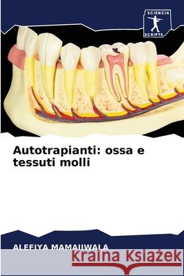 Autotrapianti: ossa e tessuti molli Alefiya Mamajiwala 9786204050287