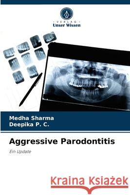 Aggressive Parodontitis Medha Sharma, Deepika P C 9786204051932