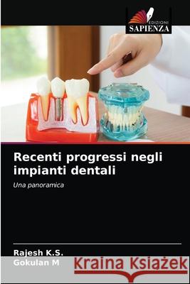 Recenti progressi negli impianti dentali Rajesh K Gokulan M 9786204059853 Edizioni Sapienza