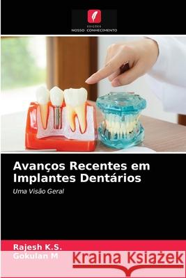 Avanços Recentes em Implantes Dentários Rajesh K S, Gokulan M 9786204059860 Edicoes Nosso Conhecimento