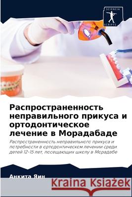 Распространенность неп&# Яин, Ан 9786204064307 Sciencia Scripts