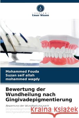 Bewertung der Wundheilung nach Gingivadepigmentierung Mohammed Fouda, Suzan Seif Allah, Mohammed Wagdy 9786204069968