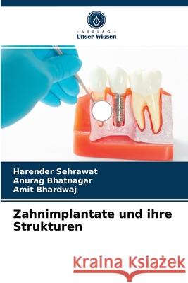 Zahnimplantate und ihre Strukturen Harender Sehrawat, Anurag Bhatnagar, Amit Bhardwaj 9786204070926