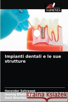 Impianti dentali e le sue strutture Harender Sehrawat, Anurag Bhatnagar, Amit Bhardwaj 9786204071077