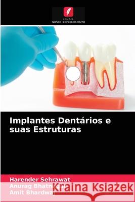 Implantes Dentários e suas Estruturas Harender Sehrawat, Anurag Bhatnagar, Amit Bhardwaj 9786204071084