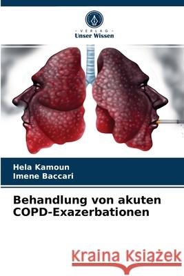 Behandlung von akuten COPD-Exazerbationen Hela Kamoun, Imene Baccari 9786204074368 Verlag Unser Wissen